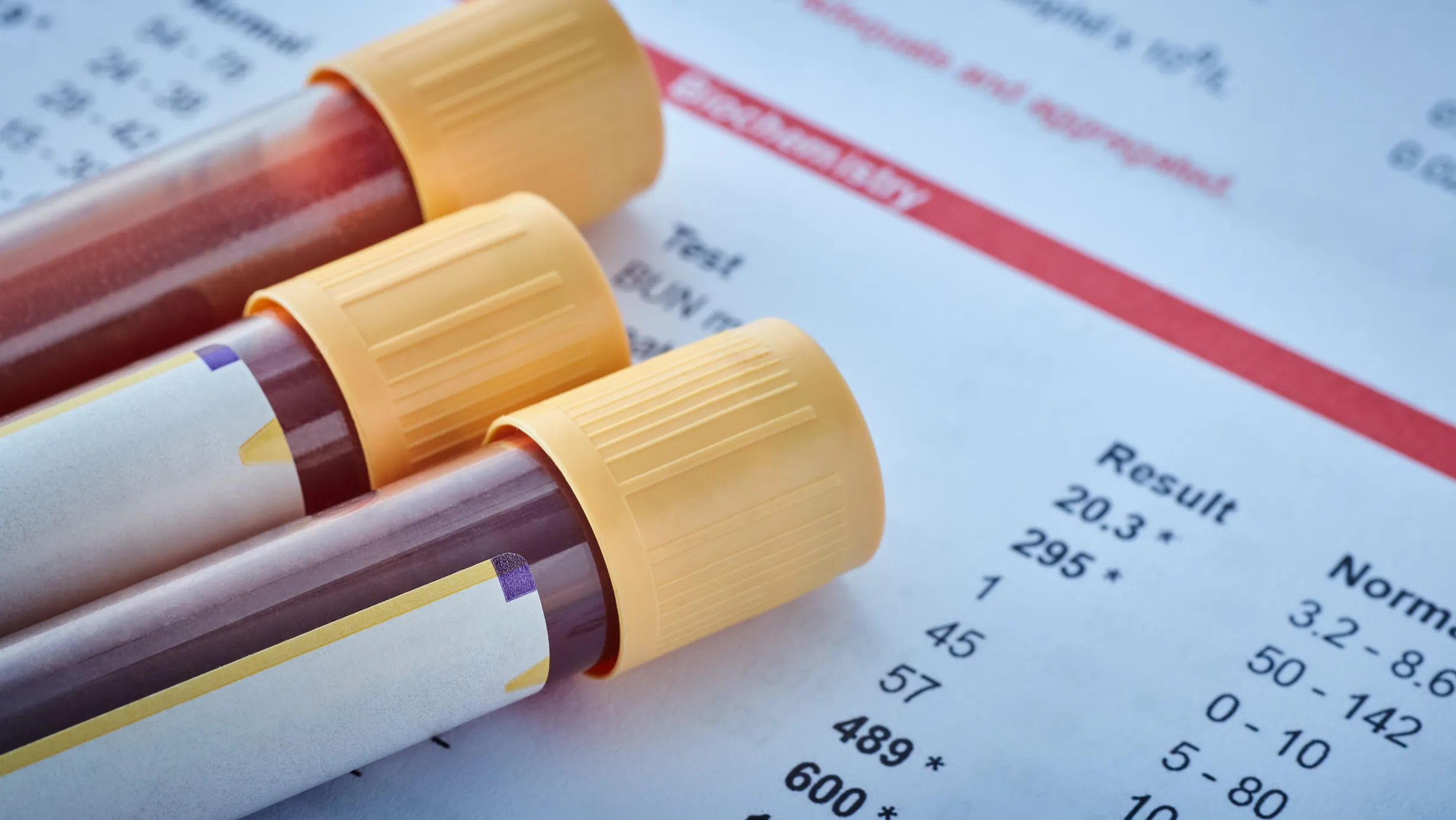 Labs To Request Before TTC